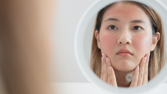 dry iritating skin of a girl